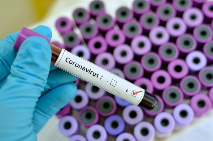 coronavirus cuba australia salud minsap casos minsap italianos turistas pandemia